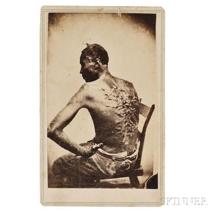 Carte-de-Visite of Enslaved Man with Whipping Scars, Escaped Slave Known as Gordon or Peter.